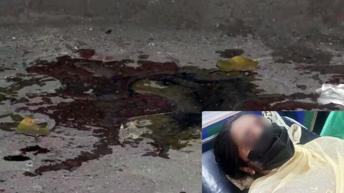 Acid Attack: बाप की साजिश... बेटी ने खुद पर छिड़का तेजाब? एसिड अटैक की कहानी में इन सवालों से आया नया ट्विस्ट