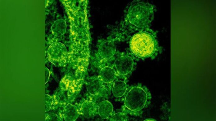 Nipah Virus: निपाह से लड़ने के लिए भारत में बनेंगी मोनोक्लोनल एंटीबॉडी, हर सप्ताह तैयार होंगी एक लाख खुराक