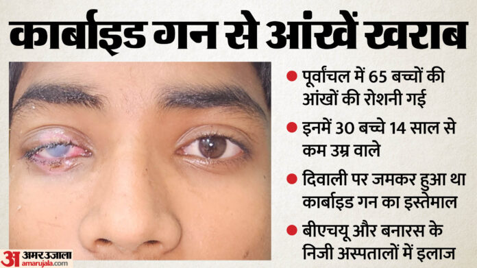 एक्सक्लूसिव: कार्बाइड गन से पूर्वांचल में गई 65 बच्चों की आंखों की रोशनी, दिवाली पर 300 रुपये में बिक रही थी बंदूक